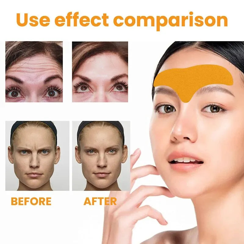 Forehead Wrinkle Patches